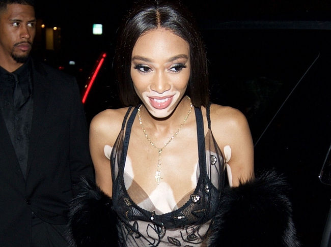 Winnie Harlow nude