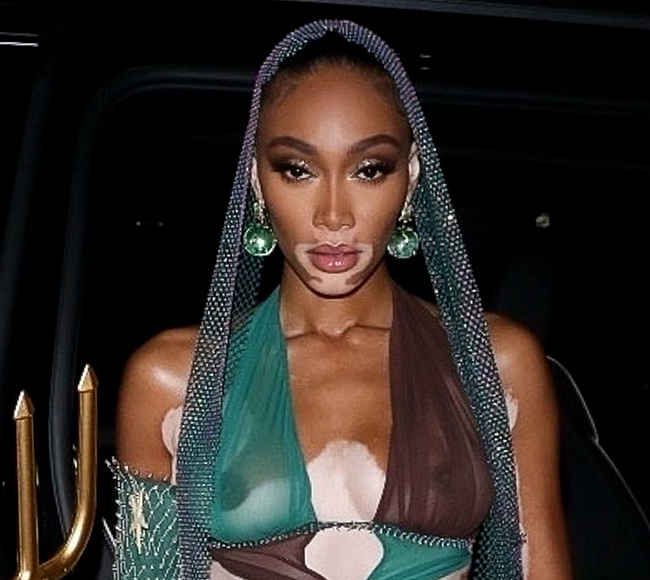 Winnie Harlow leaked nude photos