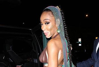 Winnie Harlow naked shots