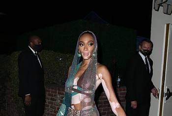 Winnie Harlow nipples