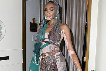Winnie Harlow no bra