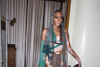 Winnie Harlow topless