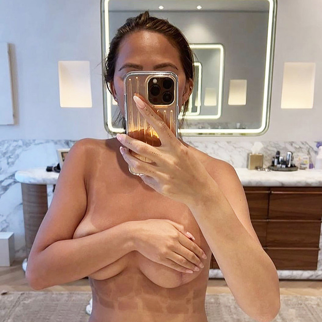 Chrissy Teigen nude photos