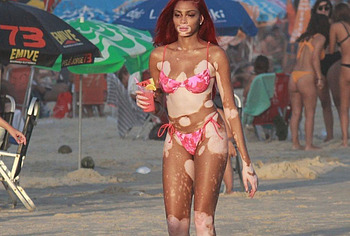 Winnie Harlow bikini